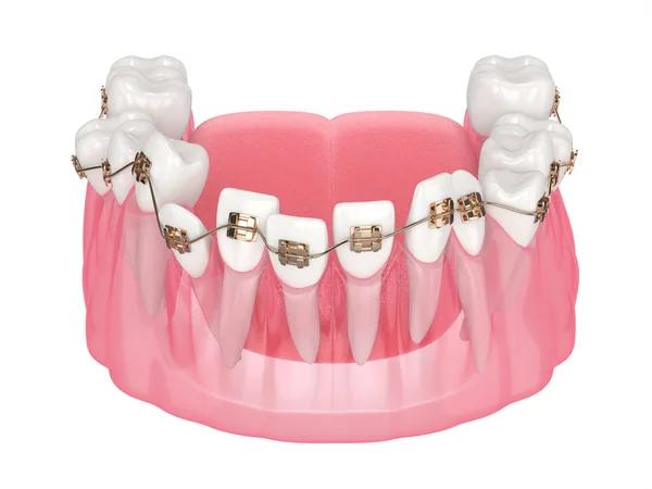Advanced Dental Alignment Options for Every Patient